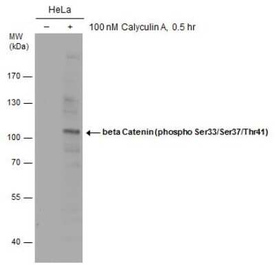 Western Blot: beta-Catenin [p Ser37, p Thr41, p Ser33] Antibody [NBP3-13118] - Untreated (-) and treated (+) HeLa whole cell extracts (30 ug) were separated by 7.5% SDS-PAGE, and the membrane was blotted with beta-Catenin (phospho Ser33/Ser37/Thr41) antibody (NBP3-13118) diluted at 1:500.